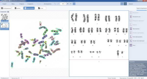 КАРИО. Выделение хромосом и их классификация
