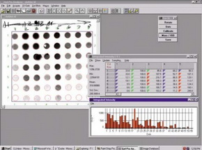 Gel-Pro Analyzer