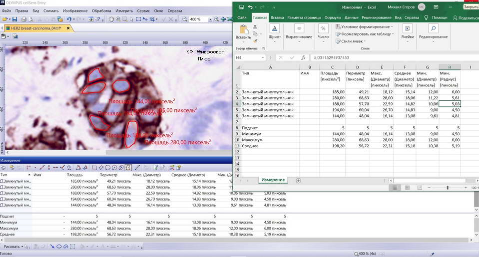 измерения и передача данных в Excel в программе для управления камерой olympus cellsens entry